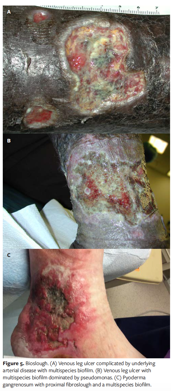 Redefining Slough New Classification System